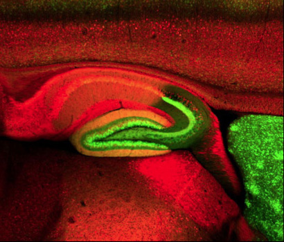 Illustration of mouse brain