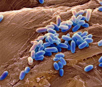 Illustration of bacteria growing on lung